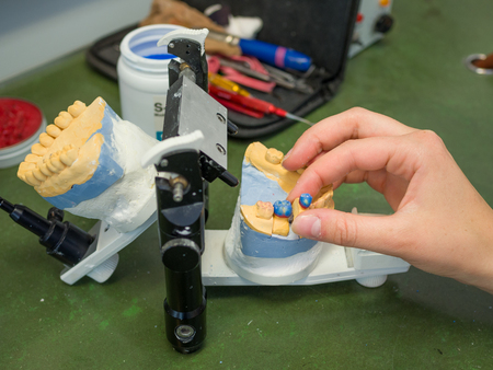 Wax crown in articulator