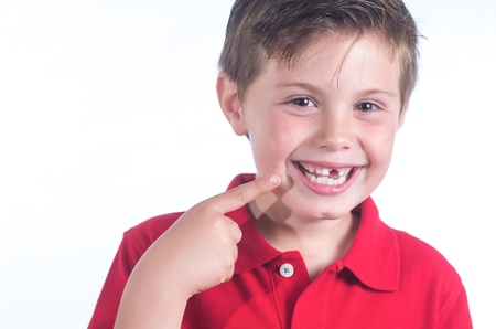 photographic portrait of a child who has lost a toothの写真素材
