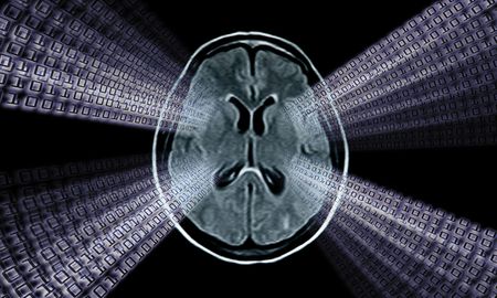 brain mri scan image for medical diagnosysの写真素材