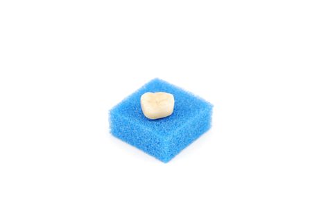 bonded crown non precious of lower right six tooth (on a blue sponge)