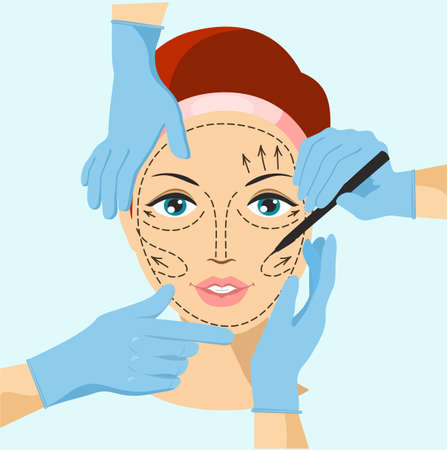 Vector illustration of hands near woman face, symbol of plastic surgery. Skin anti aging, beauty treatment. Face lifting, rhytidectomy procedure, facelift surgery concept.のイラスト素材