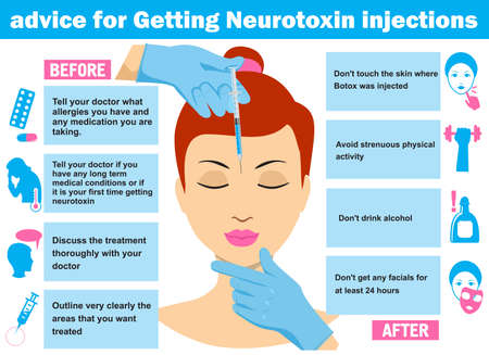 Advice for getting neurotoxin injections. Infographics. Vector illustration of woman having facial injection. Vector infographics design template. Beauty, cosmetology, anti-aging concept.のイラスト素材