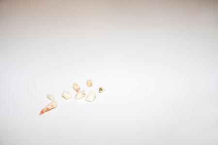 Collection of extracted milk teethの写真素材
