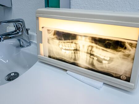 Panoramic dental X-Ray photo of middle aged manの写真素材