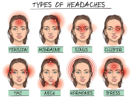 Vector cartoon illustration of some types of headaches and places on the head where the pain could be felt.のイラスト素材