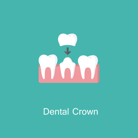 Dental crown, tooth treatment sign. Vector illustration.のイラスト素材