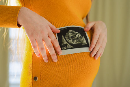 Prenatal ultrasound screening. Pregnant woman hands holding sonogram picture of unborn baby inside big belly. Happy expectant mom with fetus usi scan image. Young mother enjoying pregnancy. Maternityの写真素材
