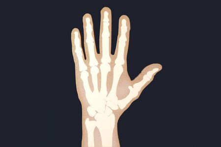 X-rayed human hand. X-ray of hand bonesの写真素材