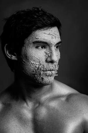 Handsome male model with the skin on his face peeling.の写真素材
