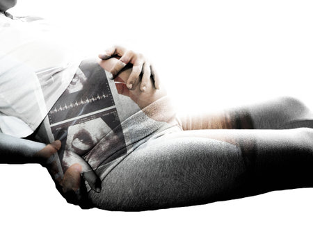 Double exposure of Pregnant woman having back aches in the last trimester of pregnancy and ultrasound scan.の写真素材