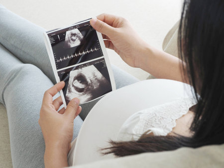 Pregnant woman holding ultrasound scanの写真素材