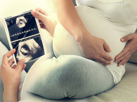 Pregnant woman hold ultrasound scan and has stomachache. Concept of Pregnancy health care.