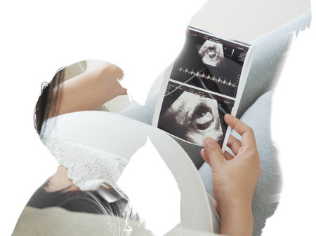 Double exposure of young asian man kissing the belly of his lovely pregnant wife and ultrasound scan isolated on white background.の写真素材