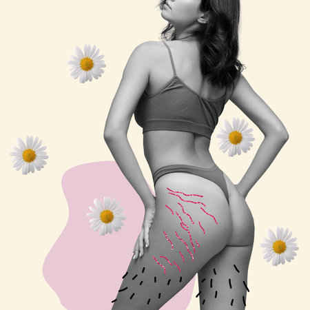 Contemporary art collage of young woman with drawn hair in different parts of body as symbol of body positive concept and self acceptance. Art, fashion, womens health, female rights conceptの写真素材