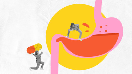 Contemporary art collage. Doctor with a giant pill treating a stomach illustration, symbolizing medication and healthcare. Concept of health care, human organism, medicine, ambulanceの写真素材