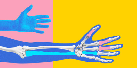 Poster. Contemporary art collage. Blue hand illustration beside skeletal hand with pink and yellow overlay elements against colorful background. Concept of medicine, healthcare, rehabilitation.の写真素材