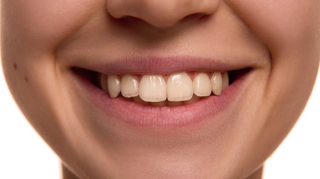 Whitening. Close up photo of female smiling mouth with healthy, white teeth against white...