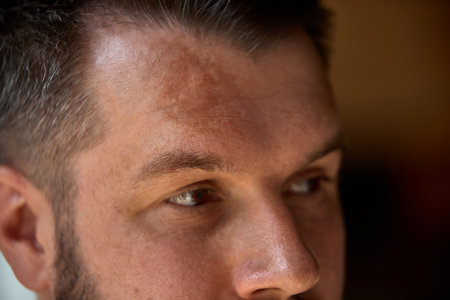 Skin-realism. Sun-kissed forehead, visible tan lines and real pores. Concept of natural beauty, no filter and male skincareの写真素材