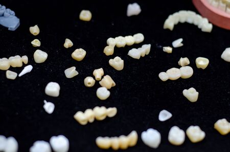 Close-up of denture manufacturing process.の写真素材