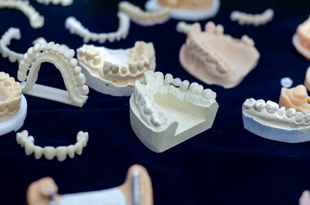Close-up of denture manufacturing process.の写真素材