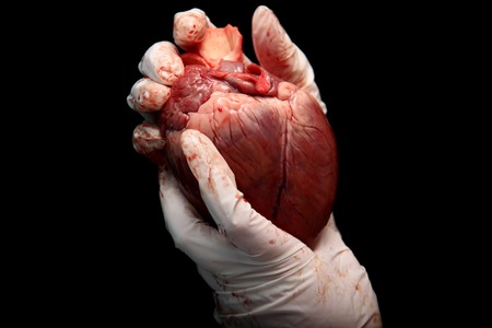 abstract illegal organ transplantation. A human heart in the hand of a surgeon woman. International...
