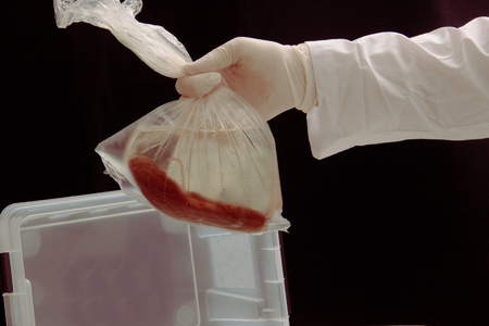 Kidney in solution in a package. mens hand in medical latex gloves gently hold the package with the organ. In the background a container for storing and carrying. Black background.の写真素材