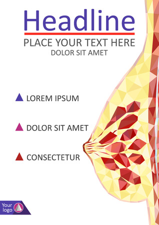 Women breast cross section in low poly. Realistic 3d medical human organ cancer.のイラスト素材