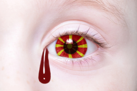 human's eye with national flag of macedonia with bloody tears. conceptの写真素材