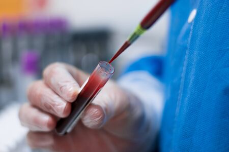 Clinical Blood Testing Tubesの写真素材