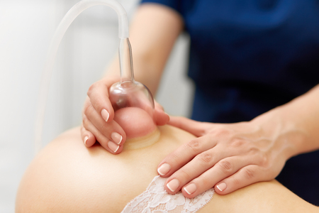 Closeup of cosmetologist doing anticellulite vacuum massage of buttocks.の写真素材