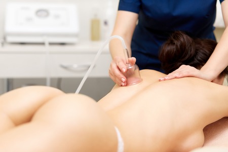 Sexy woman getting vacuum therapy procedure on her back.の写真素材