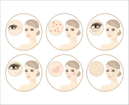 skin problemsのイラスト素材