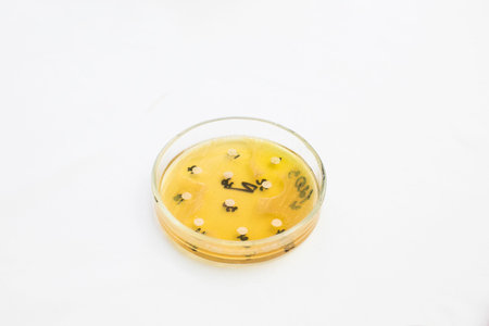 Petri dish with bacteria growing in it