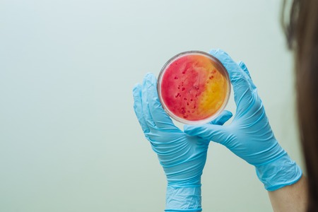 Laboratory technician testing for bacterial infection. Lab worker analyzes test sample in Petri dishes. Bacterial colonies growth. Medical hospital laboratory research. Hand holding test sample. Healthcareの写真素材