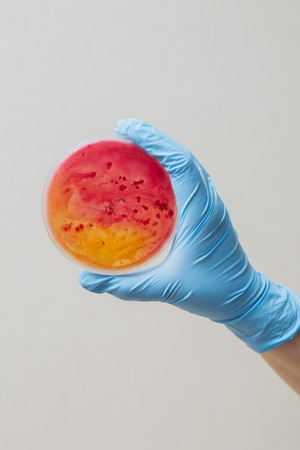 Laboratory technician testing for bacterial infection. Lab worker analyzes test sample in Petri dishes. Bacterial colonies growth. Medical hospital laboratory research. Hand holding test sample. Healthcareの写真素材