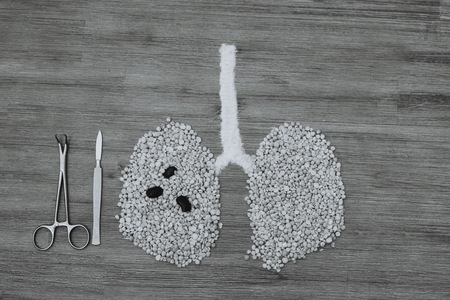Black and white image of human lungs made of dry peas. Lung cancer tumor smoking surgery air pollution concept.Air protection issue symbol. Surgical instruments forceps tongs scalpel next to the lungsの写真素材