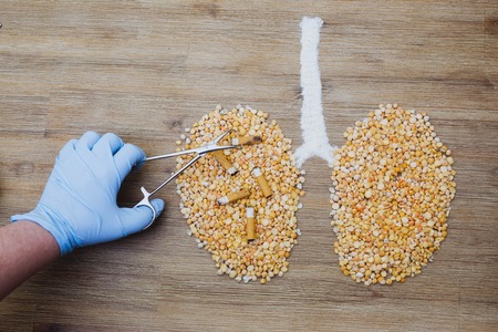 Doctor taking cigarette butts stubs out of human lungs made of dry peas. Smoking health risks, breathing polluted air concept issue. Lung disease cancer tumor surgery. Smoking is bad for your healthの写真素材