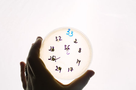 Hand holds Petri dish with E.coli Escherichia bacteria. Lab testing for intestinal...