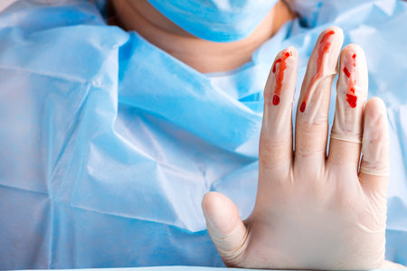 Bloody gloves on the doctorâ€™s hands, close-up