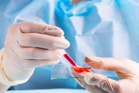 Medical equipment. Blood test.Pipette adding fluid to one of several test tubes .の写真素材