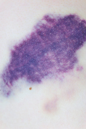 domestic violenceの写真素材