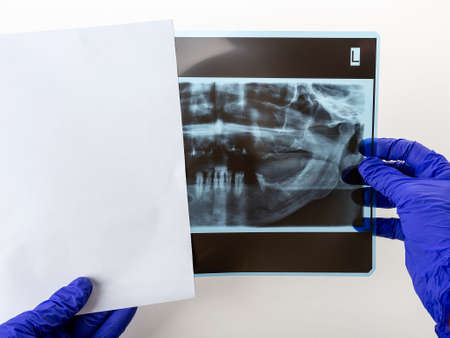 Dentist hands take the panoramic facial x-ray image out of the paper envelope. Original black white...