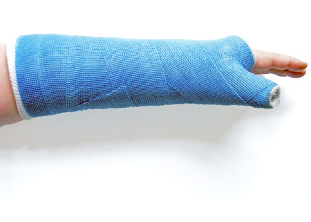 Broken wrist in cast