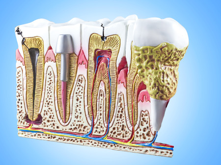 Teeth, dental section model.の写真素材
