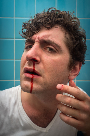 Curly haired man in bathroom with bad nose bleedの写真素材