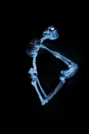 Silly dancing skeletons as seen through an xray machine