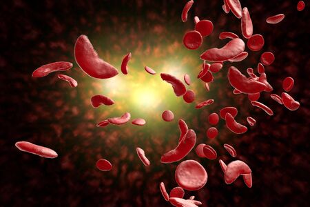 Sickle cell anemia disease (SCD) blood cells 3D illustrationの写真素材