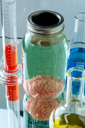 Human brain preserved in formaldehyde for science experiments and education on anatomyの写真素材