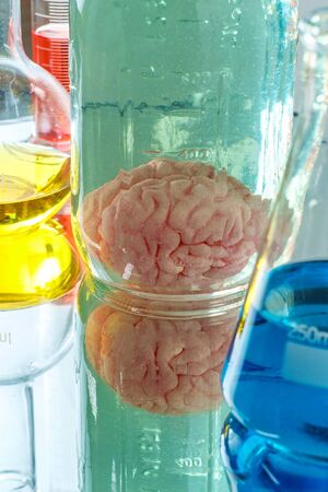 Human brain preserved in formaldehyde for science experiments and education on anatomyの写真素材