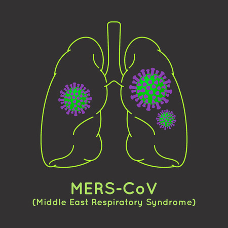 MERS-CoV(Middle East respiratory syndrome coronavirus) image illustrationのイラスト素材
